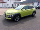 Hyundai Kona bei Gebrauchtwagen.expert - Abbildung (2 / 10)