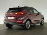 Hyundai Kona bei Gebrauchtwagen.expert - Abbildung (2 / 15) Hyundai Kona bei Gebrauchtwagen.expert - Abbildung (2 / 15)